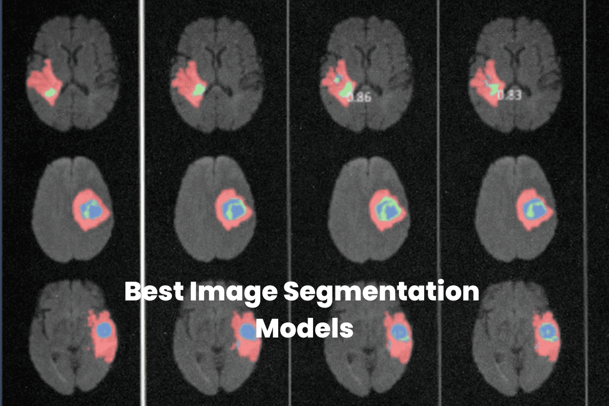 Best Image Segmentation Models [2026]