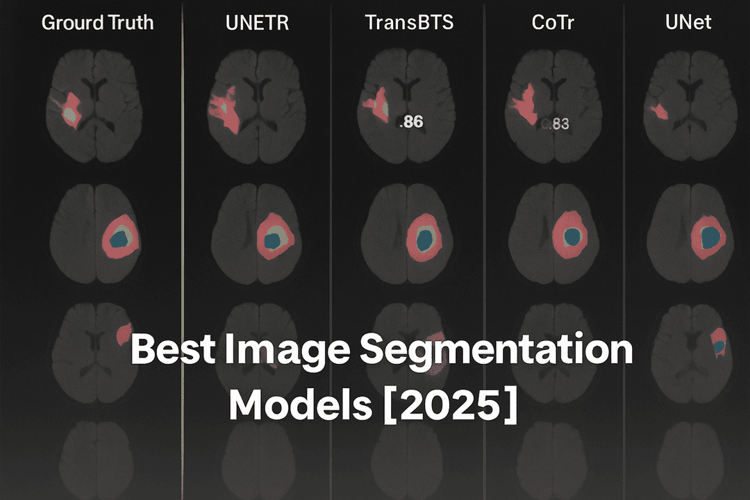 5 Types of Image Segmentation Techniques in Vision Inspection